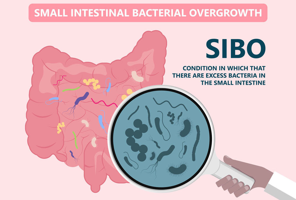 Is Your Bloating Caused by SIBO?